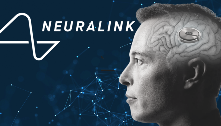 Elon Musk Confirma El Primer Implante De Un Chip Cerebral De Neuralink