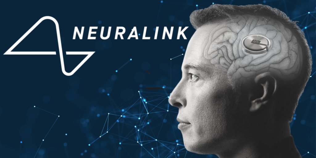 Elon Musk Confirma El Primer Implante De Un Chip Cerebral De Neuralink